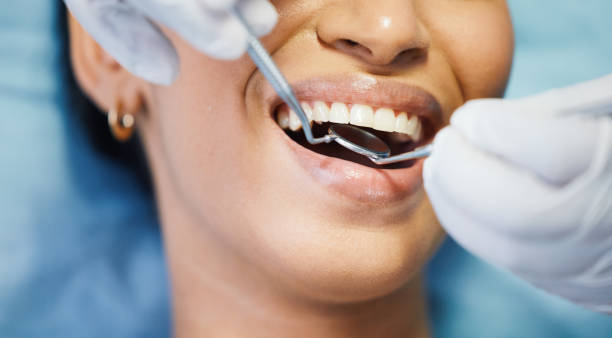 Best Cosmetic Emergency Dentistry in Reese, MI